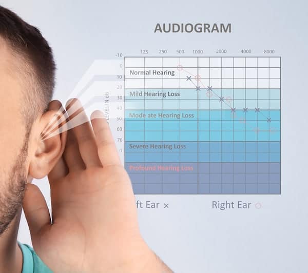 hearing loss audiogram